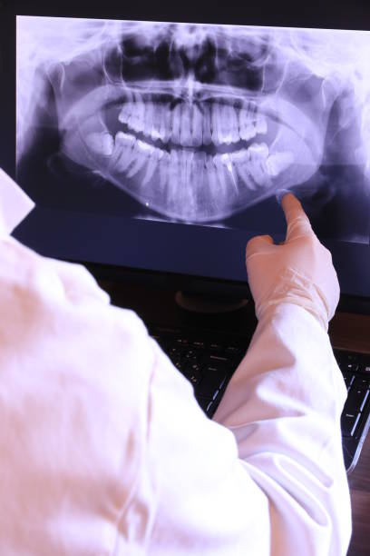 Best Emergency Tooth Extraction in Herscher, IL