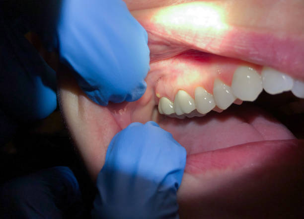 Best Pediatric Emergency Dentist in Herscher, IL