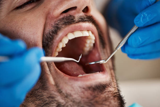 Best Emergency Denture Repair in Herscher, IL